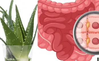 Aloe Vera for IBS